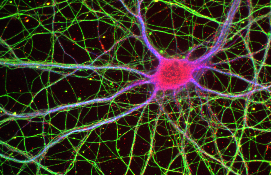 Neurodegeneration visualization